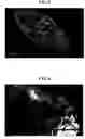 Fig. 03 - Porous cellulose aggregate and formed product composition comprising the same