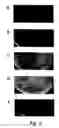 Fig. 04 - Bacteriophage-containing therapeutic agents