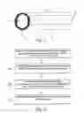 Fig. 02 - Methods of hemodialysis utilizing grafts coated with cells expressing human fibulin-5