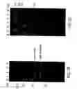 Fig. 04 - Recombinant p53 adenovirus methods and compositions