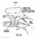 Fig. 03 - Composition for collecting placental stem cells and methods of using the composition