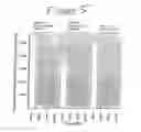Fig. 06 - FORMULATIONS THAT INHIBIT PROTEIN AGGREGATION