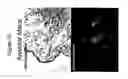 Fig. 33 - Use of A33 antigens and JAM-IT