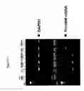 Fig. 43 - Use of A33 antigens and JAM-IT