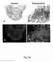Fig. 69 - Use of A33 antigens and JAM-IT