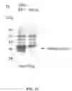 Fig. 13 - MODIFIED HPV E6 AND E7 GENES AND PROTEINS USEFUL FOR VACCINATION