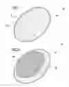 Fig. 02 - OCULAR THERAPEUTIC AGENT DELIVERY DEVICES AND METHODS FOR MAKING AND USING SUCH DEVICES
