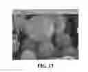 Fig. 14 - PHARMACEUTICAL COMPOSITIONS IN PARTICULATE FORM