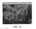 Fig. 19 - PHARMACEUTICAL COMPOSITIONS IN PARTICULATE FORM