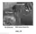 Fig. 24 - PHARMACEUTICAL COMPOSITIONS IN PARTICULATE FORM