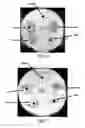 Fig. 06 - Nanoparticles for drug-delivery