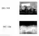 Fig. 56 - Nanoparticles for drug-delivery