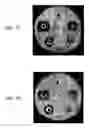 Fig. 59 - Nanoparticles for drug-delivery