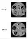 Fig. 60 - Nanoparticles for drug-delivery