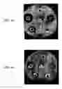 Fig. 62 - Nanoparticles for drug-delivery
