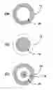 Fig. 01 - Composite Spinal Fixation Systems