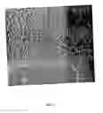 Fig. 16 - Method for patterning metal using nanoparticle containing precursors