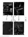 Fig. 35 - Dry-particle packaging systems and methods of making same