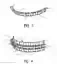 Fig. 03 - Arch bar