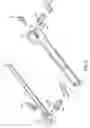 Fig. 03 - Orthodontic device and method for treating malocclusions