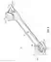 Fig. 04 - Orthodontic device and method for treating malocclusions