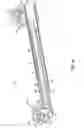 Fig. 13 - Orthodontic device and method for treating malocclusions