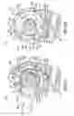 Fig. 18 - Orthodontic device and method for treating malocclusions