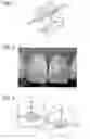 Fig. 02 - Advanced thermoplastics for orthodontics