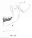 Fig. 12 - Dental apparatus for radiographic and non-radiographic imaging