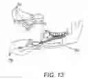 Fig. 16 - Dental apparatus for radiographic and non-radiographic imaging