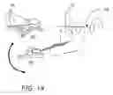 Fig. 17 - Dental apparatus for radiographic and non-radiographic imaging