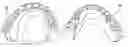 Fig. 01 - Dental prosthetic