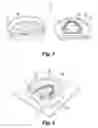 Fig. 04 - Dental prosthetic
