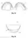Fig. 09 - Dental prosthetic
