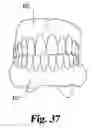 Fig. 20 - Dental prosthetic