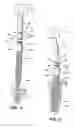 Fig. 03 - Prosthesis mounting device and assembly