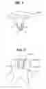 Fig. 02 - DENTAL PROSTHESIS, METHOD OF DESIGNING THEREOF, AND METHOD OF PRODUCING THEREOF