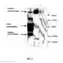 Fig. 03 - Recombinant dimeric and heterodimeric proteins comprising amino acids 193 to 252 of the β chain of the human C4BP protein