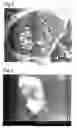 Fig. 03 - COMPOSITE BODY OF INORGANIC COMPOUND AND CELLS AND PRODUCTION METHOD THEREOF