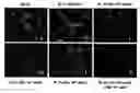 Fig. 01 - Myogenic Development and Protection of Stem Cells Against Inflammation and Apoptosis By Statins and Isoprenoid Pathway Inhibitors