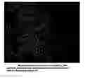 Fig. 01 - Device and method for isolating cells, bioparticles and/or molecules from liquids