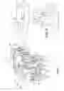 Fig. 07 - Connector assembly for an implantable medical device and process for making