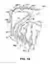 Fig. 16 - Connector assembly for an implantable medical device and process for making