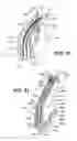 Fig. 18 - Connector assembly for an implantable medical device and process for making