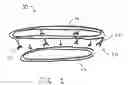 Fig. 03 - Oversized basketball rim device