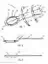Fig. 02 - Apparatus and method for tennis swing training