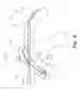 Fig. 07 - Bicycle front derailleur