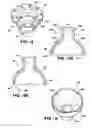 Fig. 04 - Differential with die formed housing