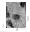 Fig. 14 - Methods for inhibiting the growth of bacteria