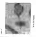 Fig. 15 - Methods for inhibiting the growth of bacteria